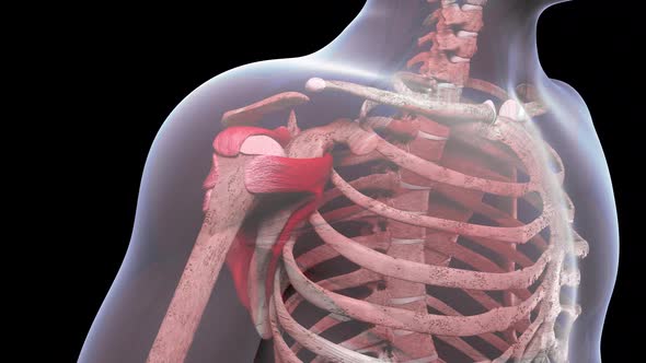 Shoulder Injury With Small Crescent Tear Of The Rotator Cuff alt