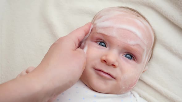 Applying Curing Lotion or Ointment on Baby Cheecks Suffering From Dermatitis and Acne alt
