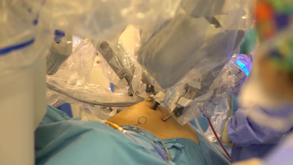 Robot Prostate Surgery 3