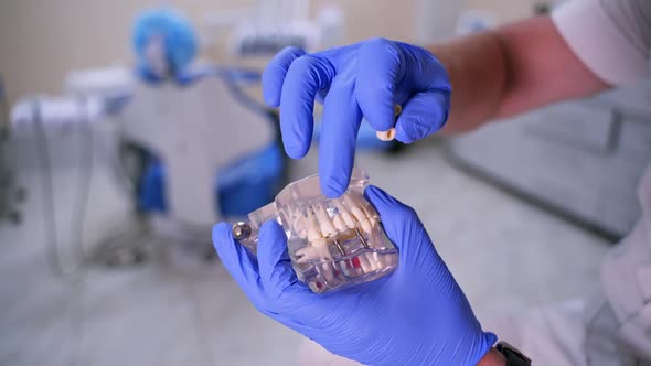 Jaw model in hands. Dentist showing on a jaw model how to put teeth where necessary. alt