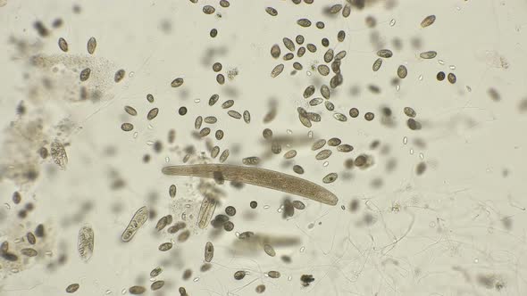 Accelerated Movement of a Large Colony of Ciliates of the Ciliates, Which Are Largely in Dirty alt