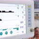 Non-invasive ventilation in a patient  - VideoHive Item for Sale