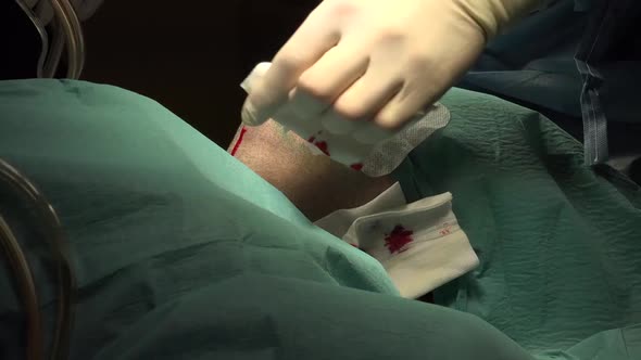 Face and Neck Liposuction for Man  2
