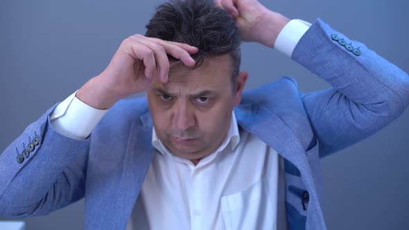 The bald man is wearing a wig. alt