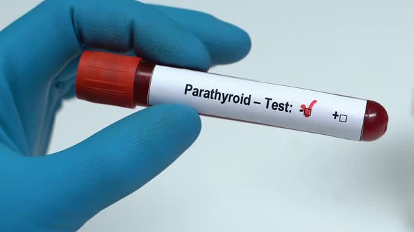 Parathyroid, Doctor Holding Blood Sample in Tube Close-Up, Health Check-Up alt