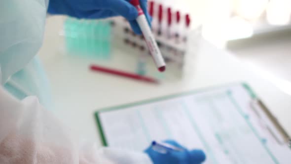 Closeup of Microbiologist Hand with Blue Surgical Gloves Looking Blood Test Result As Positive for alt