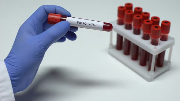 beta-hcg-test-doctor-showing-blood-sample-in-tube-lab-research