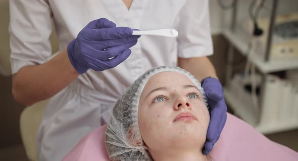 Applying Peeling on the Face alt