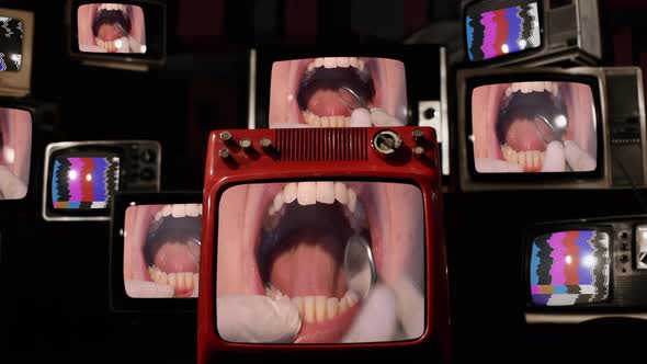 Young Girl with Open Mouth at Dentist on Retro TVs. 4K.