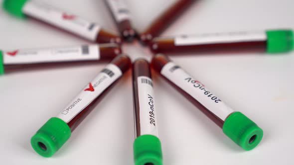 Coronavirus test tubes rotate on white background. Coronavirus icon.