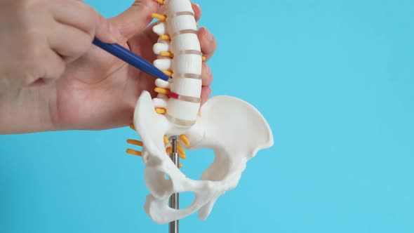 Intervertebral Hernia of the Cervical Spine Rupture of the Fibrous Ring alt