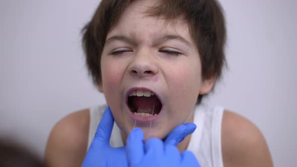 Closeup Face of Ill Caucasian Boy Opening Mouth As Unrecognizable Doctor Checking Oral Cavity with alt