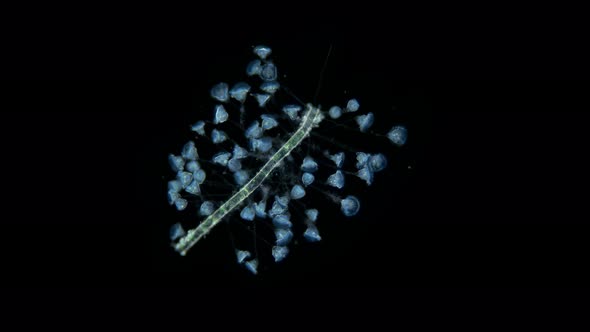 Infusoria Ciliophora Vorticella Under the Microscope Class Oligohymenophorea alt