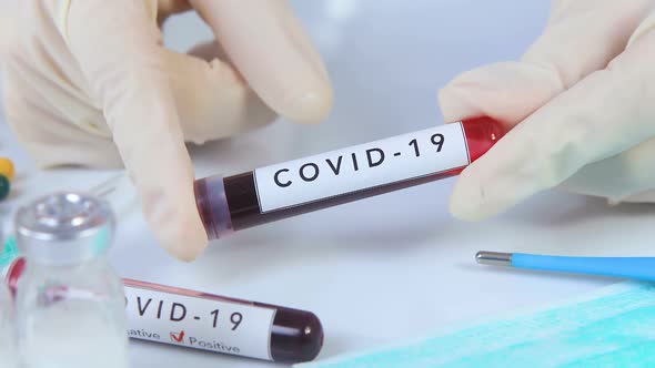 Analyst Hands Holding COVID 19 Coronavirus Blood Test 