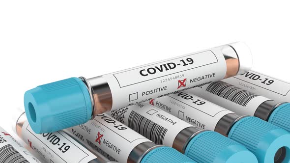 Covid-19 nasal swab laboratory tests