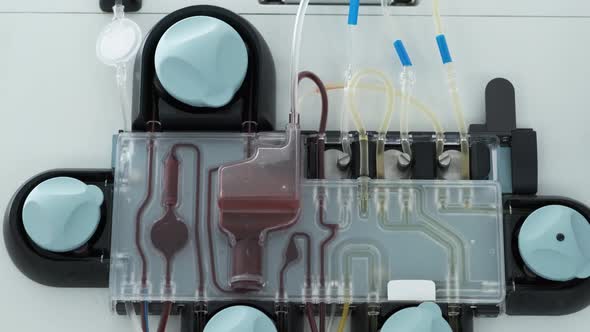 Apparatus for Plasmapheresis Close Up. Removal, Treatment, Return or Exchange of Blood Plasma or alt
