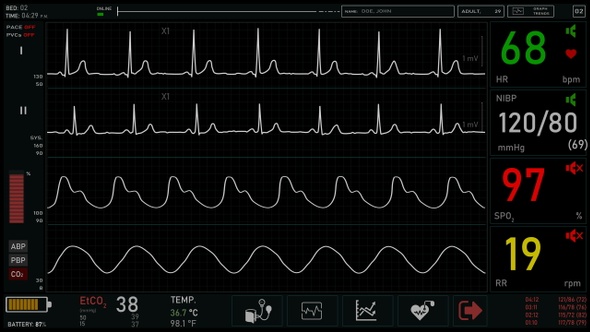 Cardiac Monitor (Themplate+4 waveforms, alpha)