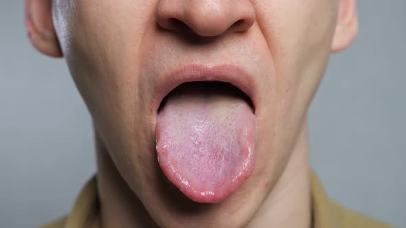 Unrecognizable Man Shows Infection Tongue alt