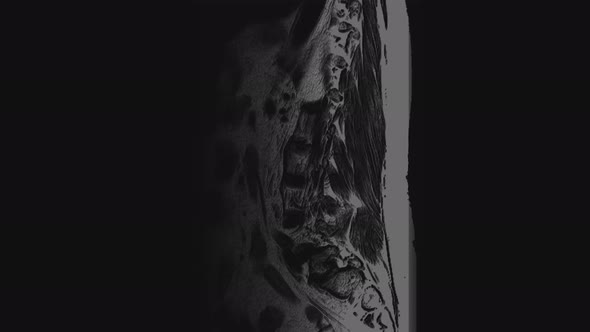 Voluminous MRI of the Female Pelvic Organs, Abdominal Cavity, Gastrointestinal Tract and Bladder alt