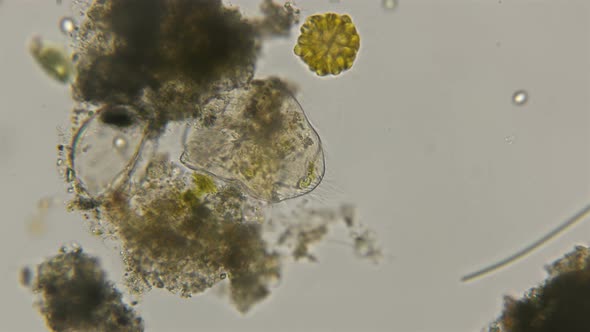 Anaerobic Ciliate Brachonella alt