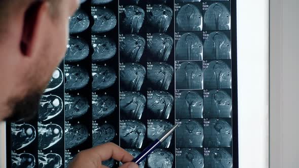 Doctor in hospital is looking at x-ray MRI scan alt