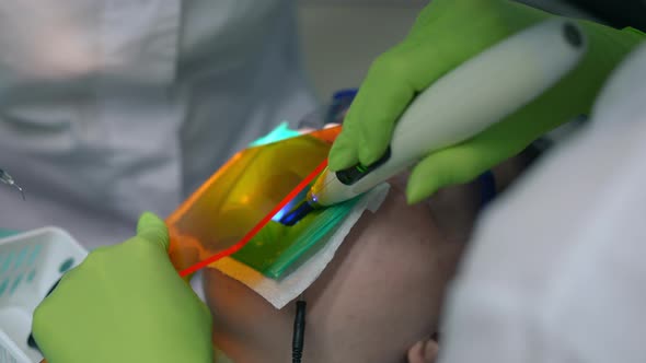 Closeup Dental Assistant Using Dental Curing Light in Slow Motion in Stomatological Clinic alt