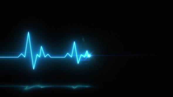 Electrocardiogram hd