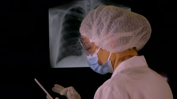 The doctor looks at the x-ray of the lungs. Pneumonia diagnosis