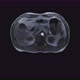 Voluminous Color CT Scan of the Abdomen - VideoHive Item for Sale